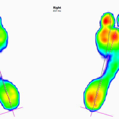 Phits Orthotics